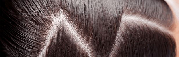 couro cabeludo oleoso causa queda de cabelo